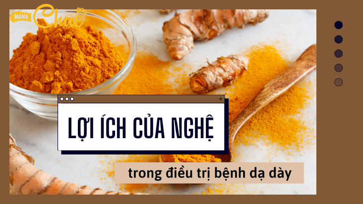 lợi ích của nghệ