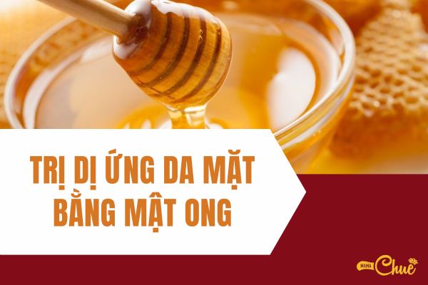 tri di ung da mat bang mat ong